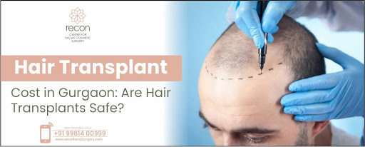 Best Hair Transplant Cost in Gurgaon - Recon & Cosmetics